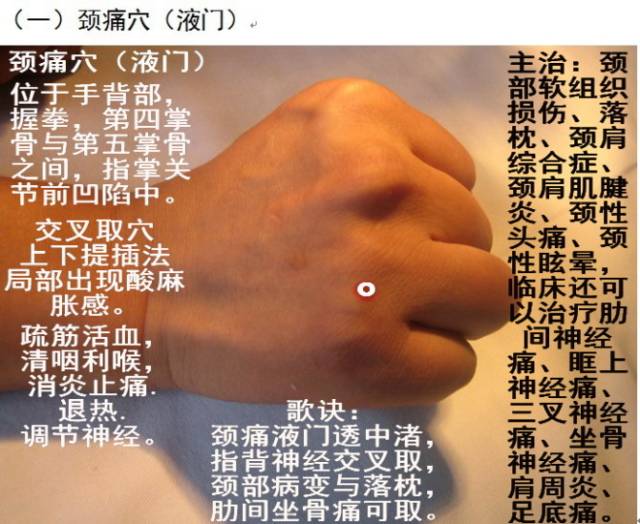 全套平衡针灸图解——建议收藏