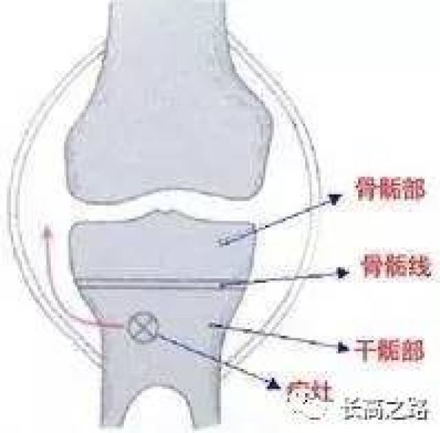 有关骨骺闭合能长高的知识点都在这里了