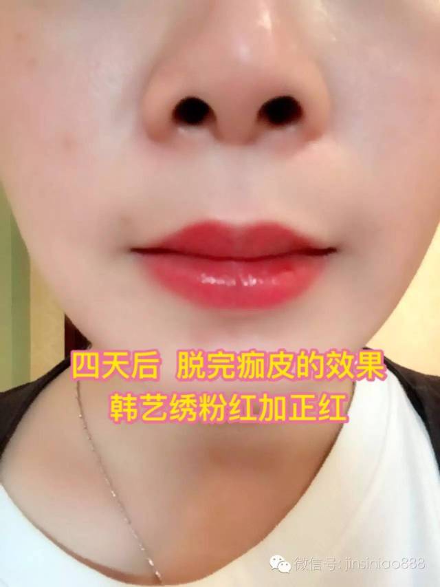 《详解》半永久漂唇常见问题及解决方案
