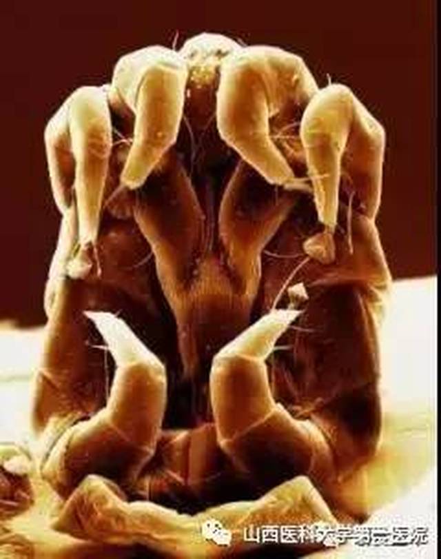 健康科普丨过敏患者看不见的敌人-屋尘螨