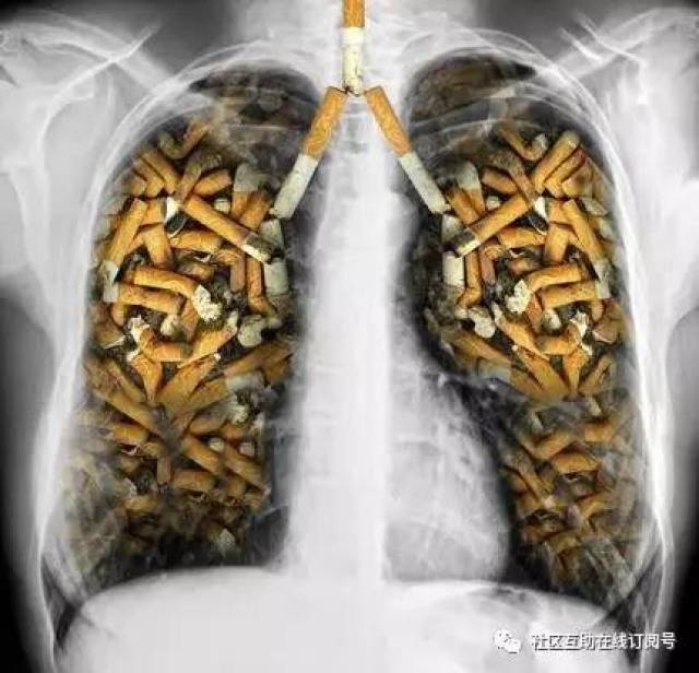 戒烟后,肺部还能恢复正常吗,需要多久?