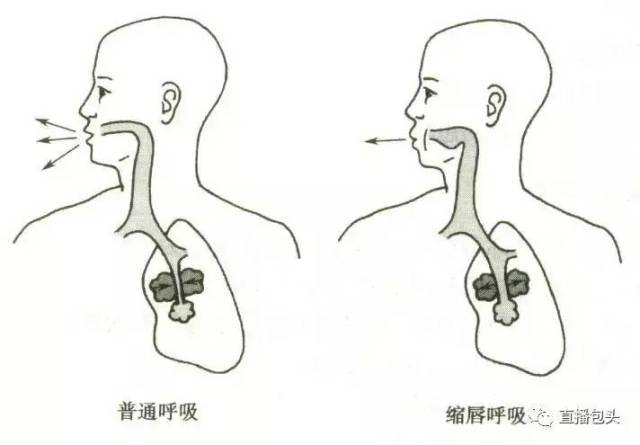 过敏季节呼吸疾病高发,两种呼吸法可缓解!