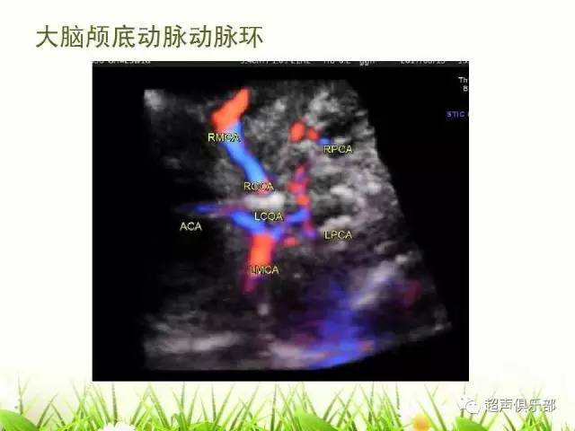 【图示 手绘】读懂正常胎儿颅脑超声