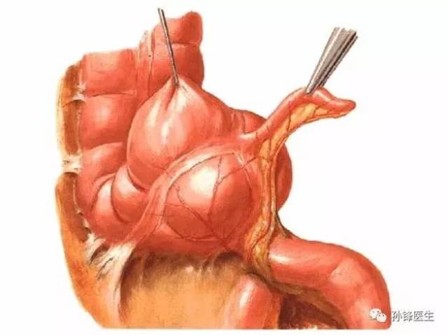 医学干货|25张精美的解剖图谱:结直肠肛门外科医生的福利来了!