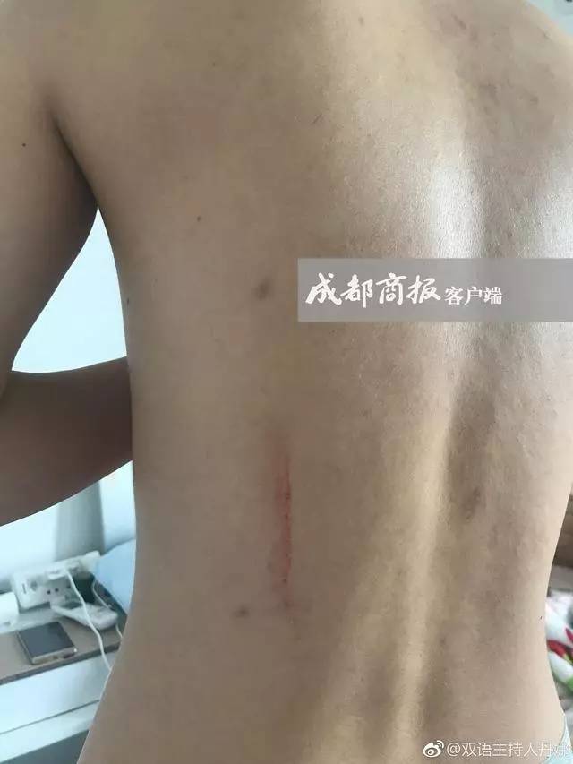 成都女主持自曝遛狗未拴牵引绳遭暴打,网友吵翻了!