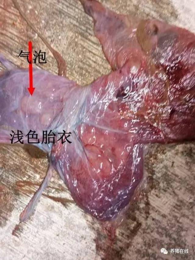 胎盘不下怎么解决?