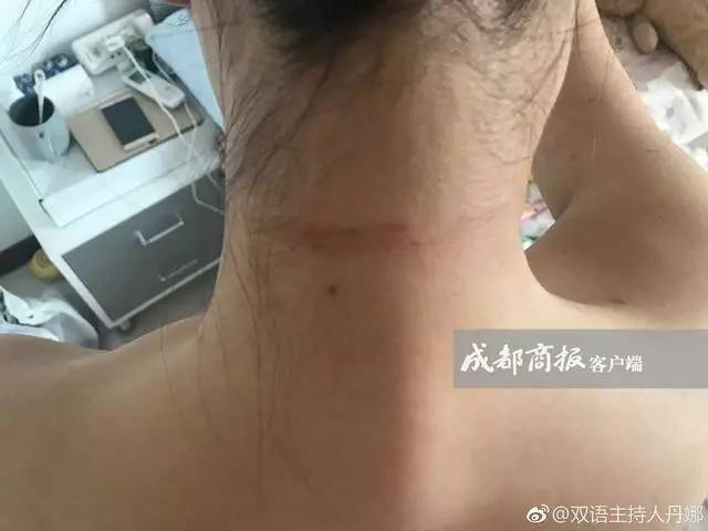 成都女主持自曝遛狗未拴牵引绳遭暴打,网友吵翻了!