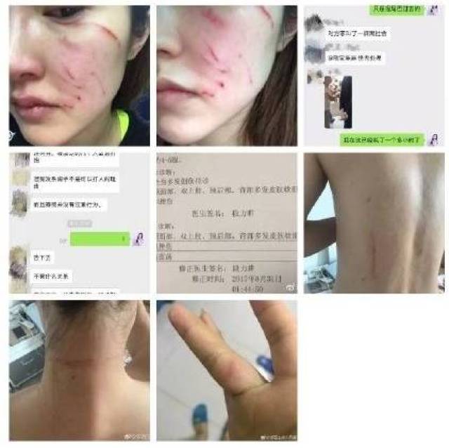 女主持人遛狗不拴绳遭暴打!遛狗不栓绳,这事你怎么看?