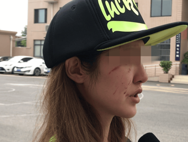 女主播遛狗未拴绳遭邻居暴打发文道歉:对不起,吓到孩子了