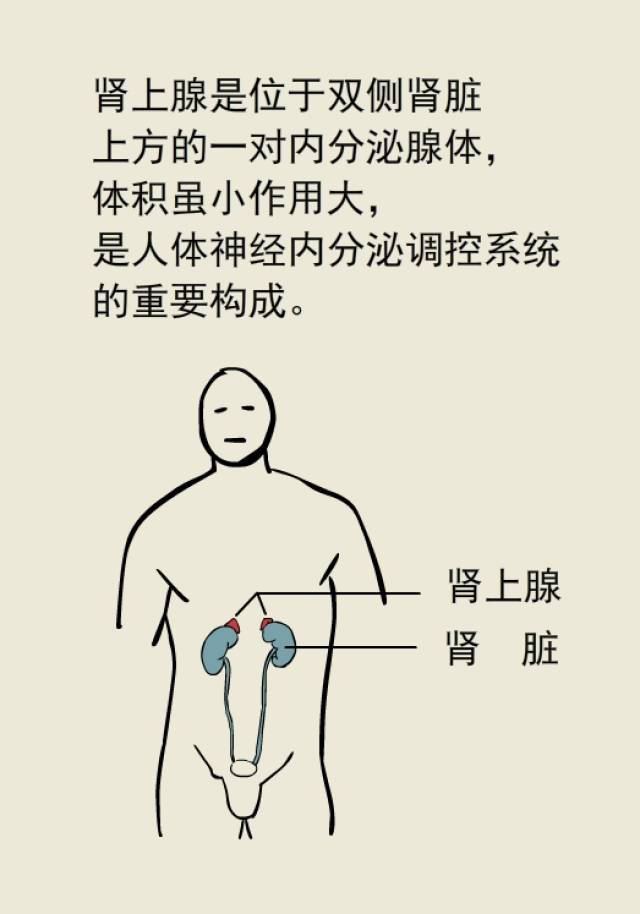 切除肾上腺肿瘤居然治好了高血压 ?