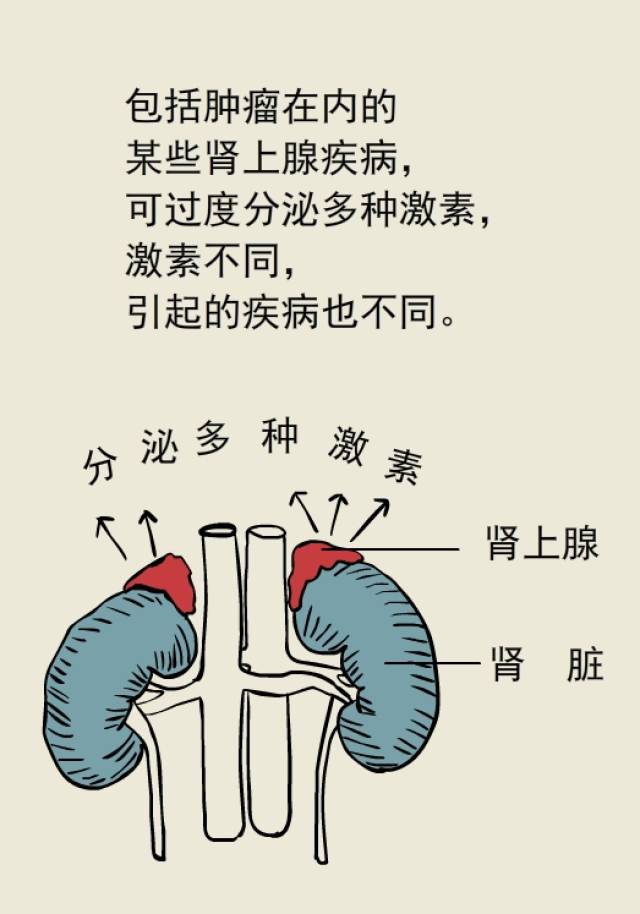 切除肾上腺肿瘤居然治好了高血压 ?