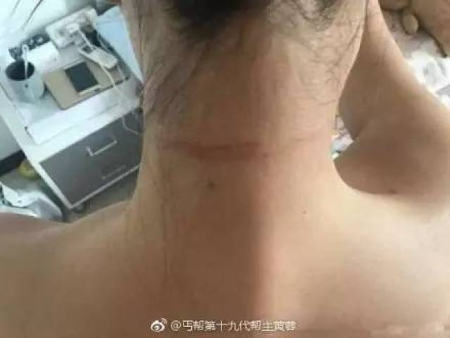 美女主播在自家小区被人暴打,竟是因为“暖男”大金毛……