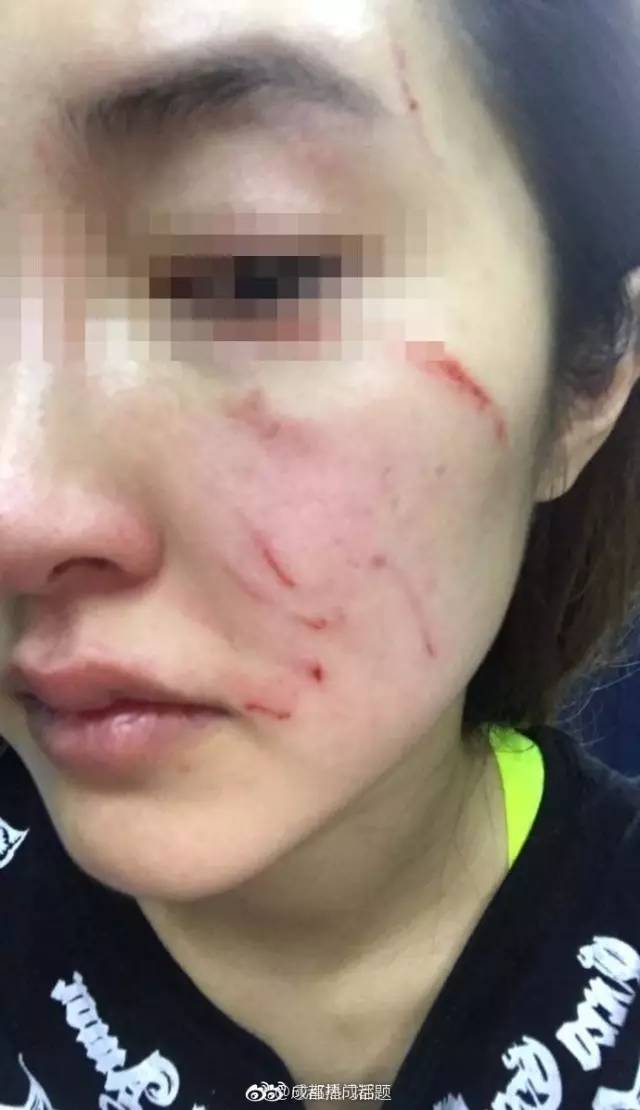 女主持人遛狗不栓绳遭暴打,到底冤不冤?