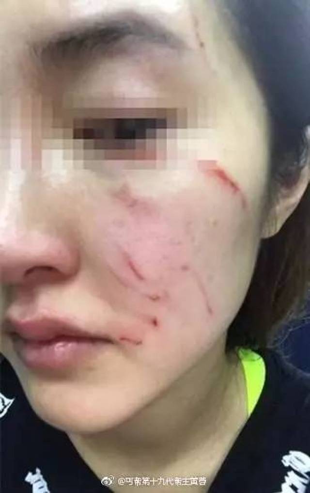 美女主播在自家小区被人暴打,竟是因为“暖男”大金毛……