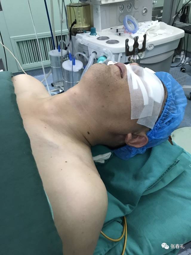 患者已经全麻成功,我的小兄弟和器械护士已经摆好手术体位,垫肩等