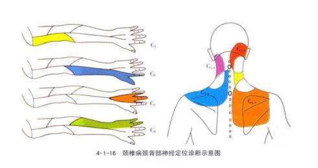 麻木,下肢踩棉花感等时,则必须考虑颈椎病的可能,及时到脊柱神经外科