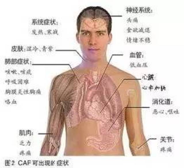 库欣综合征(cushing"s syndrome)又称皮质醇增多症(hvpercortisolism