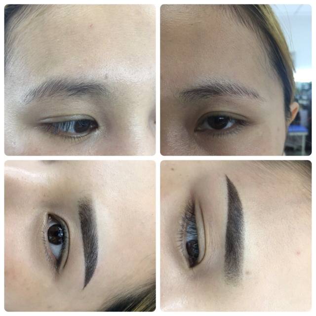 造成永久的画眉效果,这种纹眉技术一般要求整形医生根据受术者的脸型