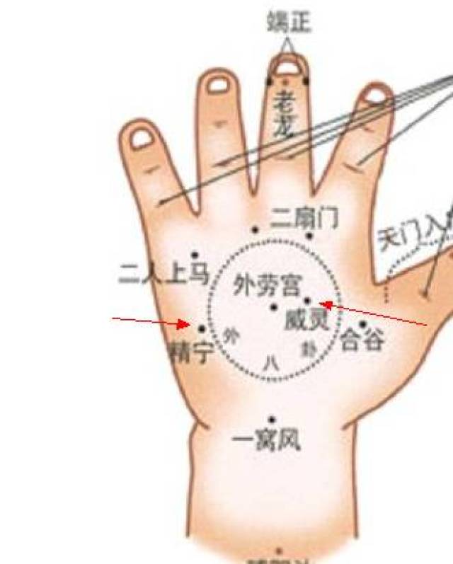 以两手食,中二指固定患儿的腕部,同时以拇指掐患儿之精宁,威灵二穴,并