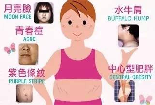 库欣综合征(cushing"s syndrome)又称皮质醇增多症(hvpercortisolism