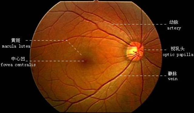 视力下降,视物变形,当心不是眼花而是黄斑裂孔