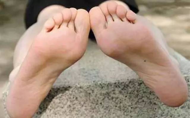 脚底长痣