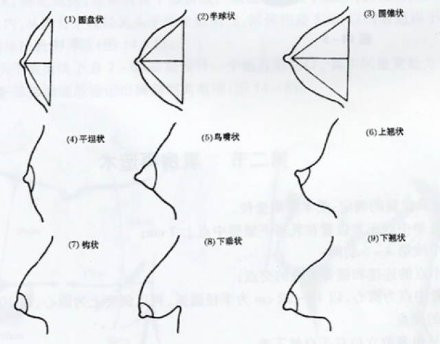 史上最完整胸型分析你知道自己胸部哪里不完美了吗