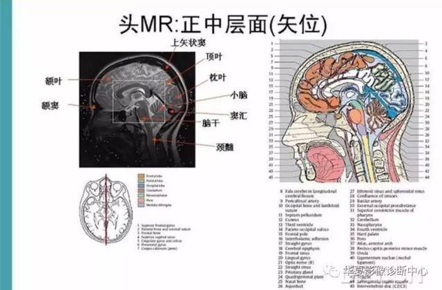 完整的头颅mri解剖 ,值得收藏!