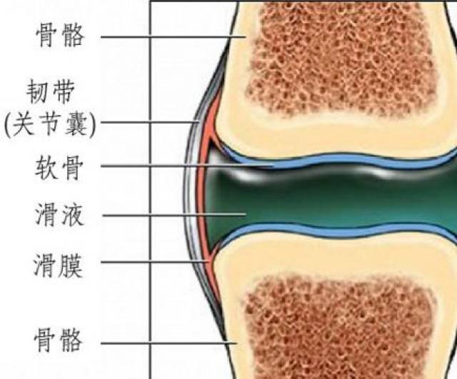 滑膜组织发生炎症称为滑膜炎,主症是关节积液.