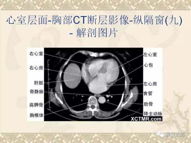 胸,上腹部和盆腔ct图谱