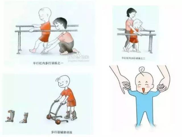 【图文详解】小儿脑瘫康复训练:根据运动发育顺序,有步骤进行