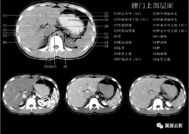 正常肝脏ct解剖
