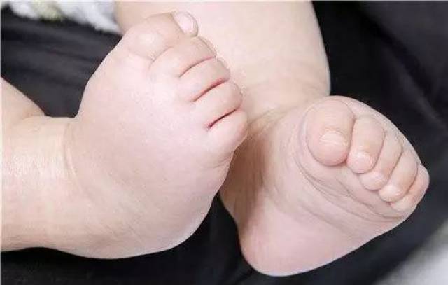 脚上出现红点痒是什么原因 0dd63b14e9ed40cca00765fce45eb2ca.jpeg