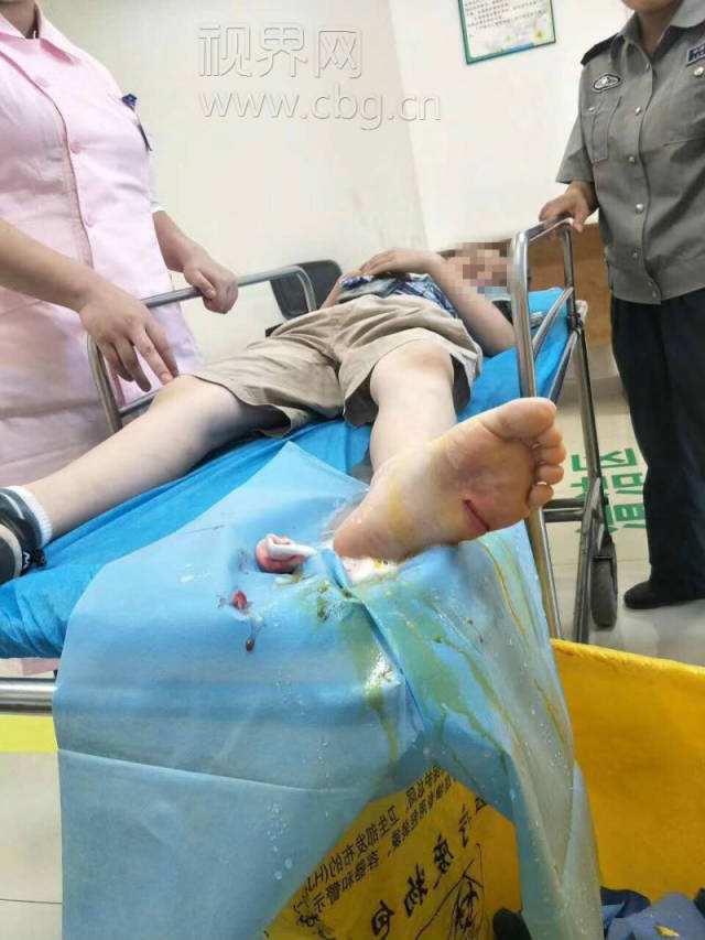 陈杰,窦小波立即前往救援 ,在现场看到孩子踩中的时一块钉满钉子的
