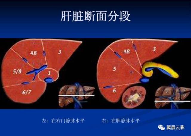 正常肝脏ct解剖