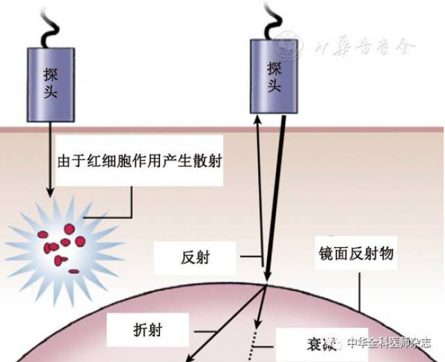 超声波的物理特性