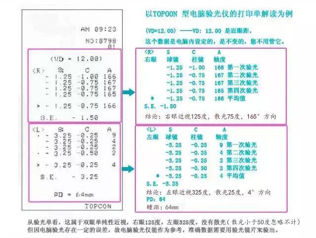 1张图让你轻松看懂验光单