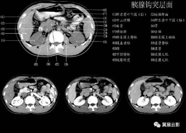 正常肝脏ct解剖