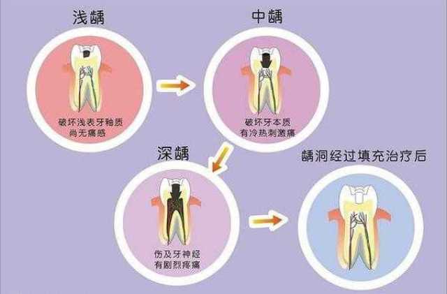 宝宝的牙齿健康问题居然有这么多影响