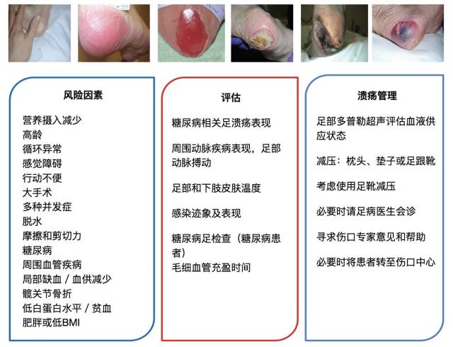 英国社区足跟压疮预防经验