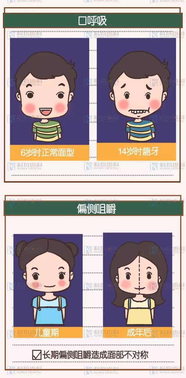 聊聊儿童牙齿早期干预的那些事儿