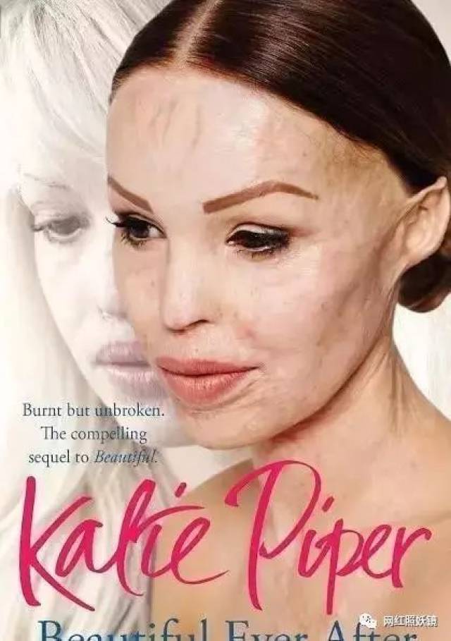 这位超模被泼硫酸毁容、遭强奸性虐待,如今整