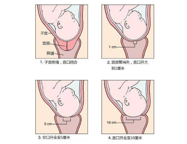 生孩子时的"开10指",是要将双手全部伸到里面?看完真心疼女人