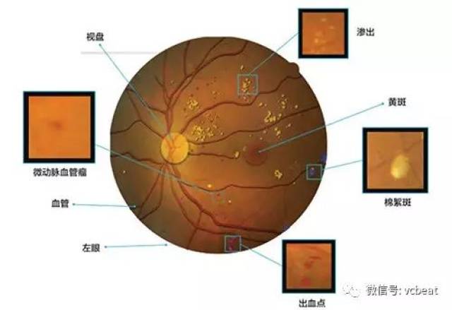 2017人工智能+医学影像产业研究报告