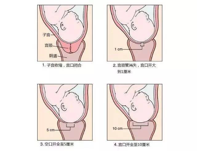 生孩子时的"开10指",是要将双手全部伸到里面?