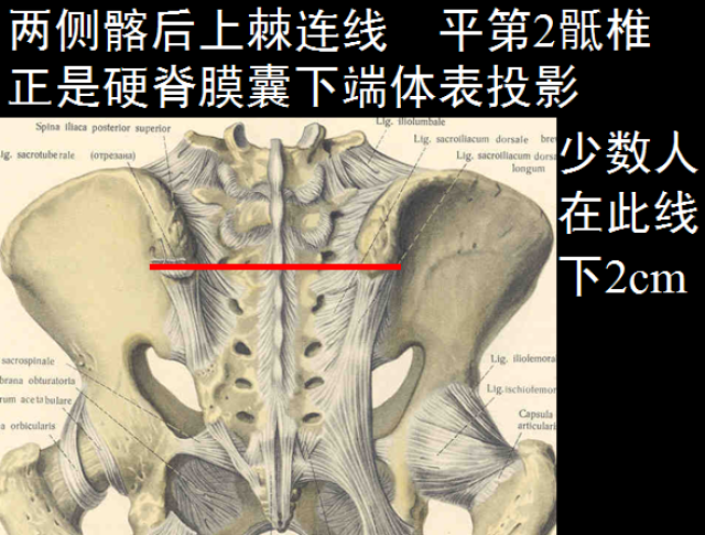 椎管解剖(高清大图)