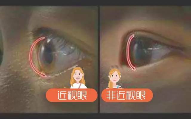 眼球的长与短,其实通过眼科检查是 可以测量的,就像度数一样.