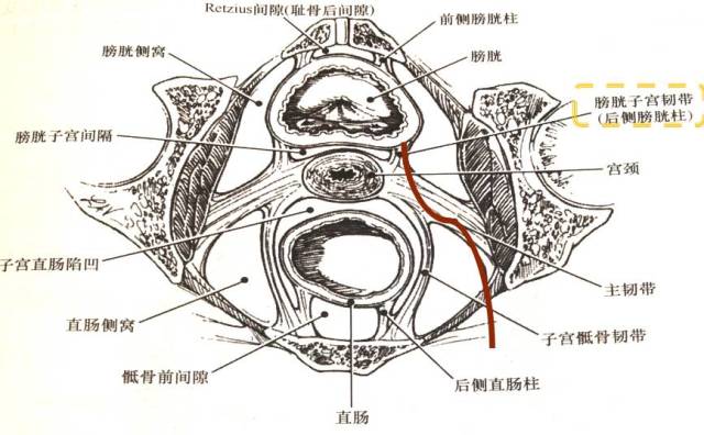 三带:主韧带,骶韧带,膀胱宫颈韧带 落实六个间隙:子宫切除的应用解剖