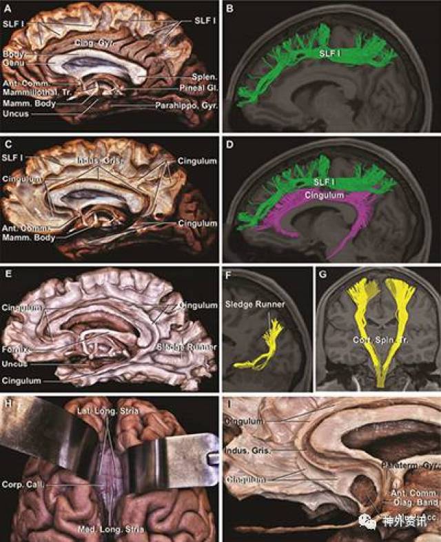大脑半球内侧面及底面的纤维束解剖