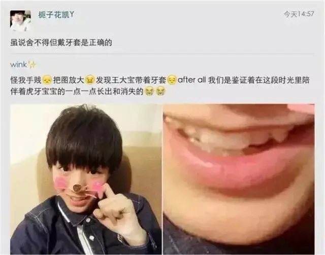 看明星们矫正虎牙结果怎样了呢